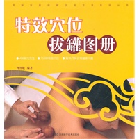 图解家庭保健实用方法系列丛书 特效穴位拔罐图册