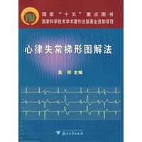 心律失常梯型图解法