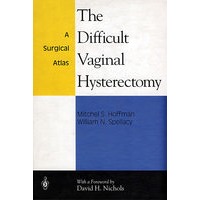 阴道与子宫切除术的区别 The Different Vaginal Hysterectomy